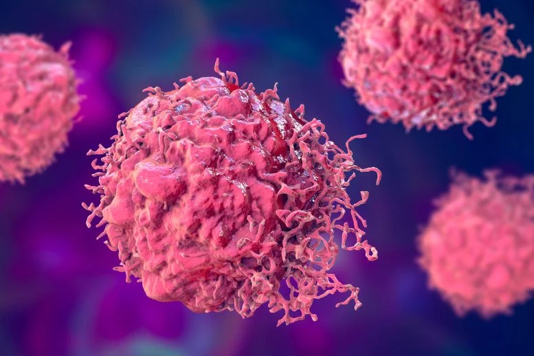 Immune Cells Meant To Fight Cancer Are Secretly Helping Tumors Grow