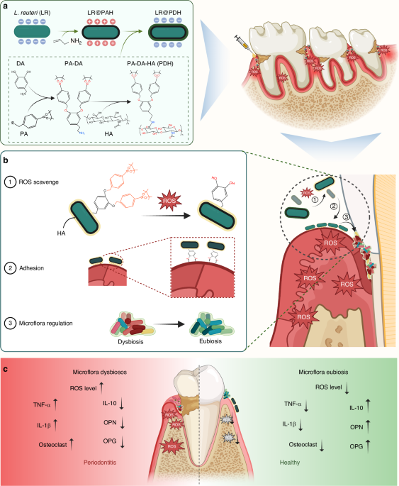 Engineered Lactobacillus reuteri for scavenging reactive oxygen species and modulating oral microflora in periodontitis therapy