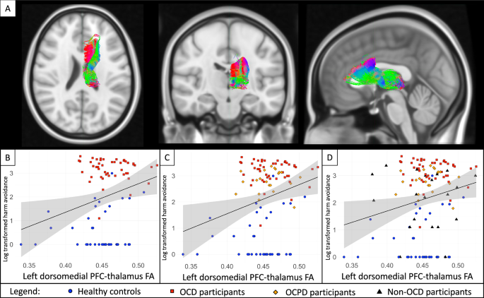 Medial prefrontal-thalamic white matter microstructure is associated with harm avoidance in OCD: a discovery and transdiagnostic replication study