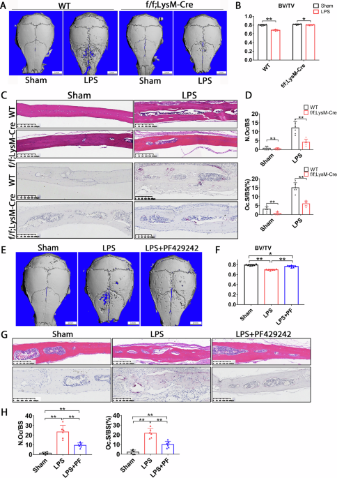 Correction: Site-1 protease controls osteoclastogenesis by mediating LC3 transcription