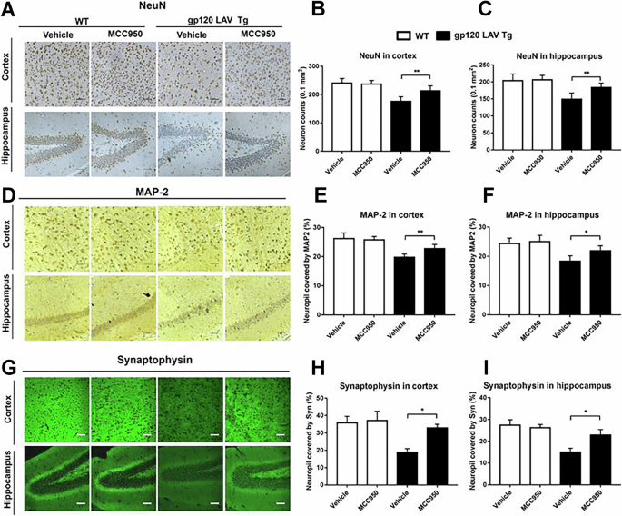 Author Correction: NLRP3-dependent pyroptosis is required for HIV-1 gp120-induced neuropathology