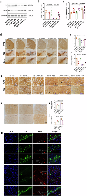 Author Correction: Alternate-day fasting ameliorates α-synuclein pathology and suppresses inflammation via the gut-brain axis in an MPTP-induced subacute mouse model of Parkinson’s disease