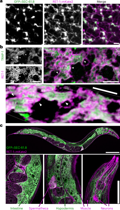 ER remodelling is a feature of ageing and depends on ER-phagy