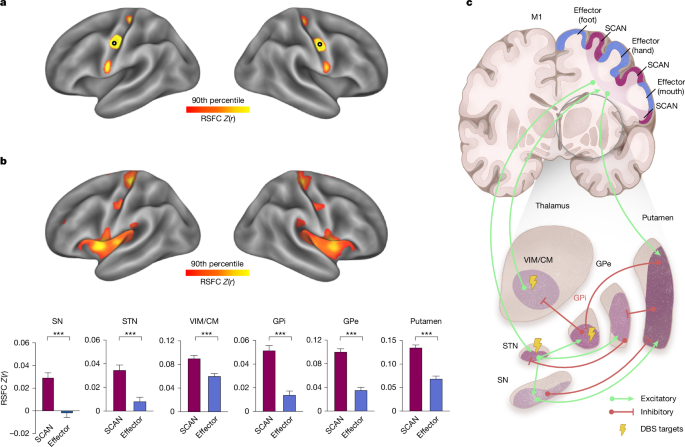 Parkinson’s disease as a somato-cognitive action network disorder