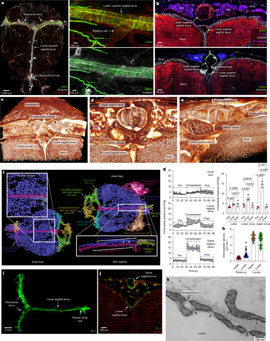 Highly dynamic dural sinuses support meningeal immunity