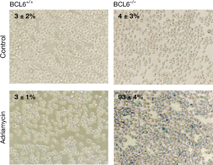 Author Correction: BCL6 enables Ph+ acute lymphoblastic leukaemia cells to survive BCR–ABL1 kinase inhibition