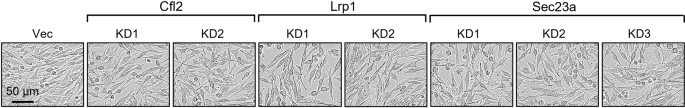 Editorial Expression of Concern: Direct targeting of Sec23a by miR-200s influences cancer cell secretome and promotes metastatic colonization