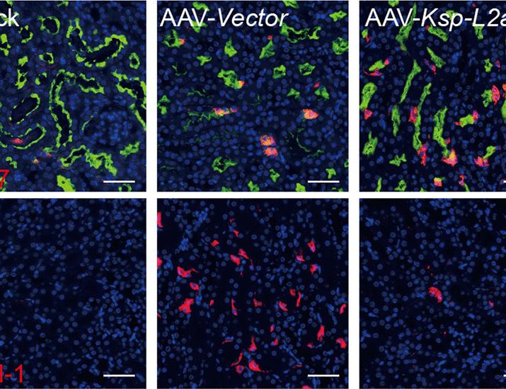 Chaperone-mediated autophagy supports organ regeneration and fibroblast quiescence in mouse models of fibrosis | Science Translational Medicine