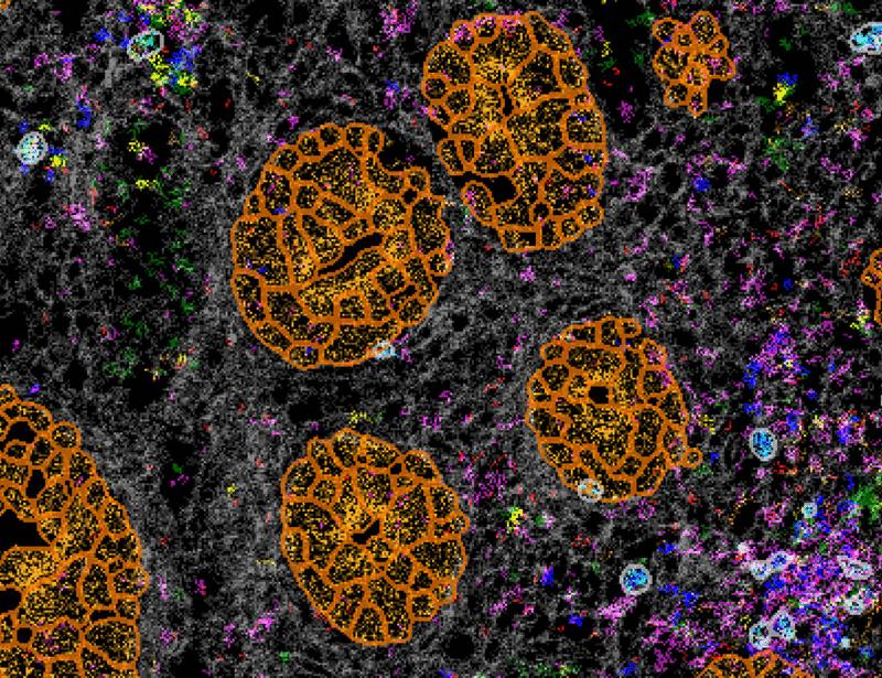 Single-cell profiling reveals diverse γδ T cell subsets in ulcerative colitis | Science Immunology