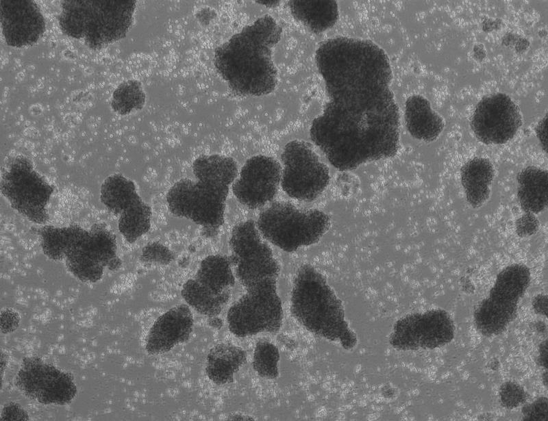 Human LFA-1 governs T cell immune surveillance of the skin | Science Immunology