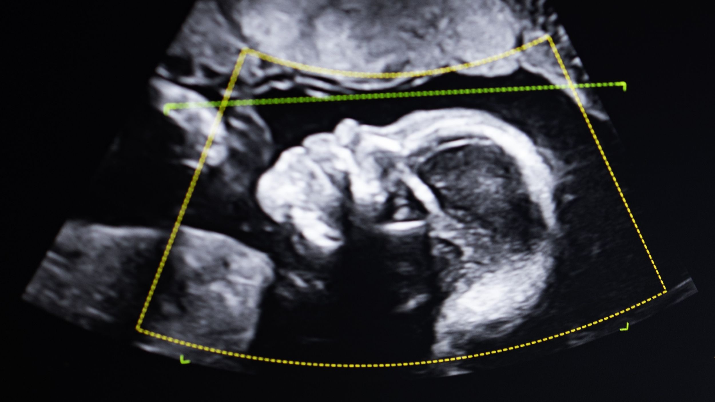 ‘It doesn’t lie. So who are you?’: What happens when DNA tests show a woman is not the mother of the child she gave birth to?