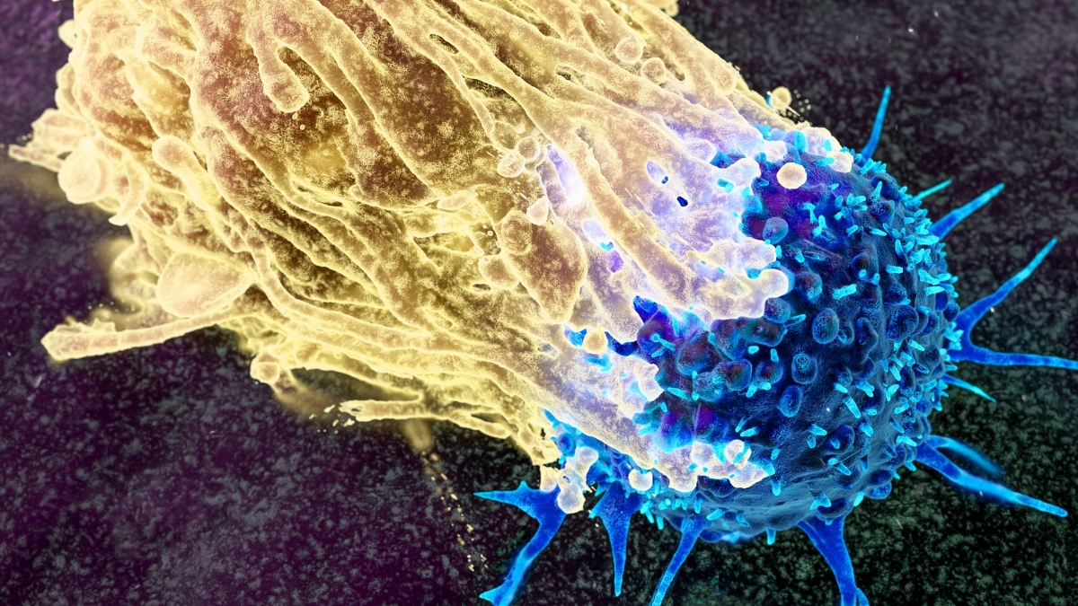 Scientists Want to Intercept Cancer Decades Before It Develops. Here’s How. : ScienceAlert