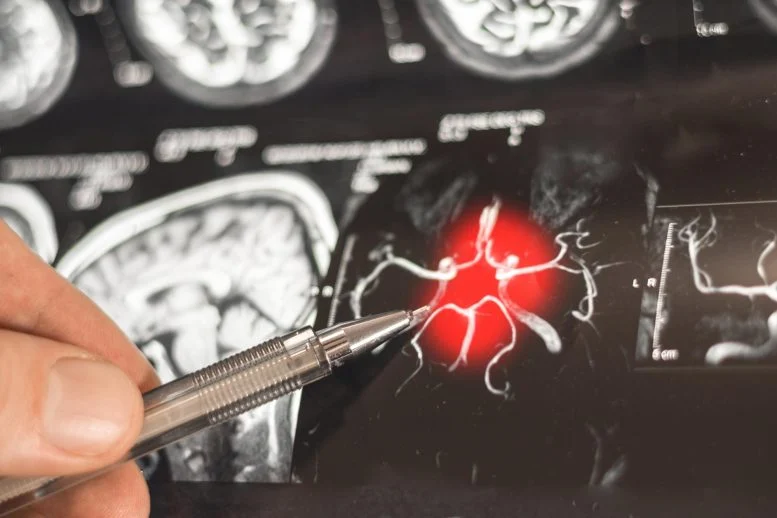 New “Cellular” Target Could Transform How We Treat Alzheimer’s Disease