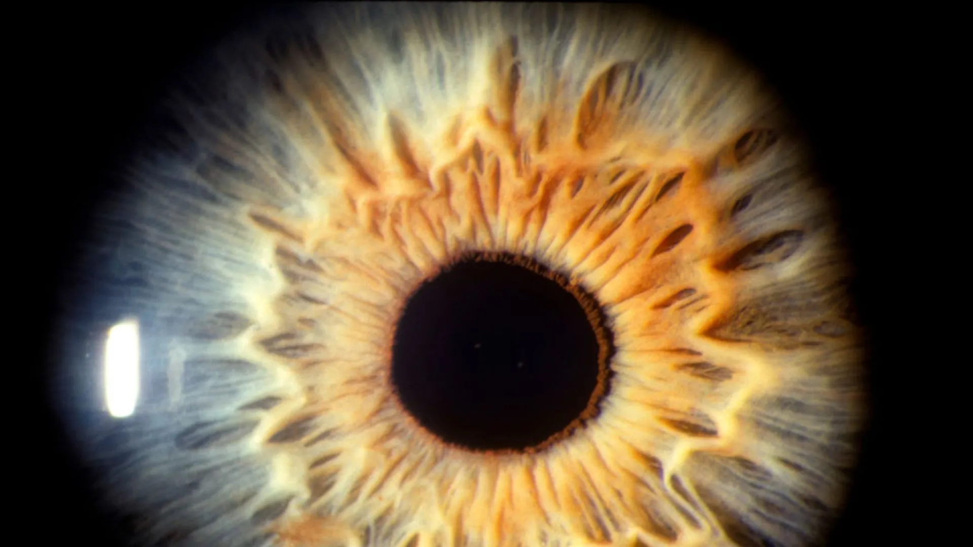 Lab-grown retina reveals secret of sharp human vision growth in eyes