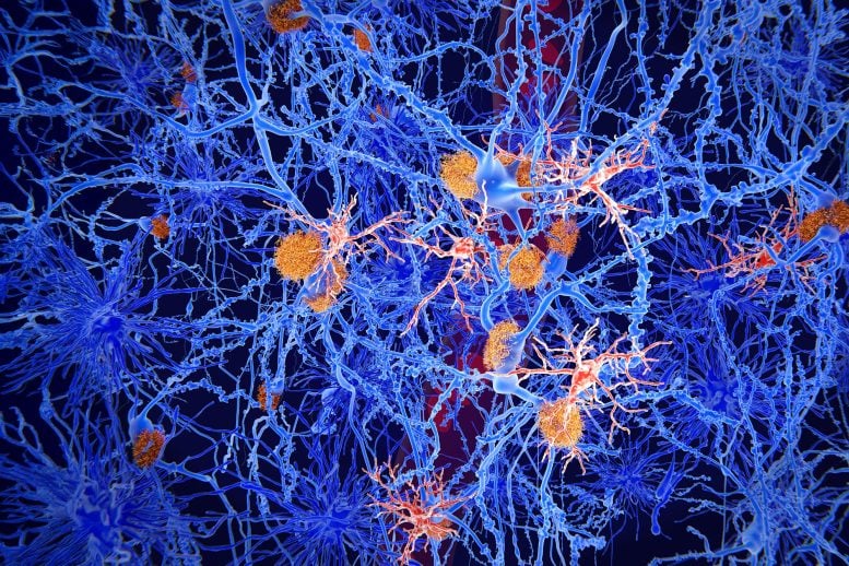 Scientists Uncover a Hidden Early Stage of Alzheimer’s That They Can Stop