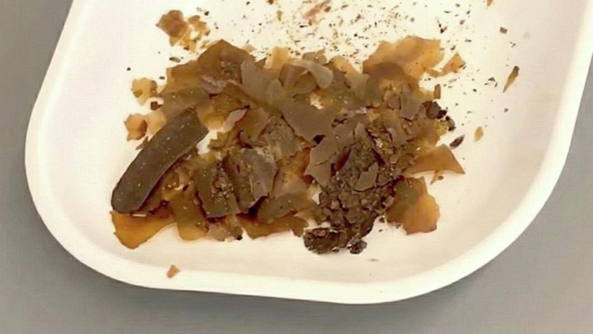 Ancient Romans Really Did Use Poop as Medicine. We Just Got The First Real Proof. : ScienceAlert