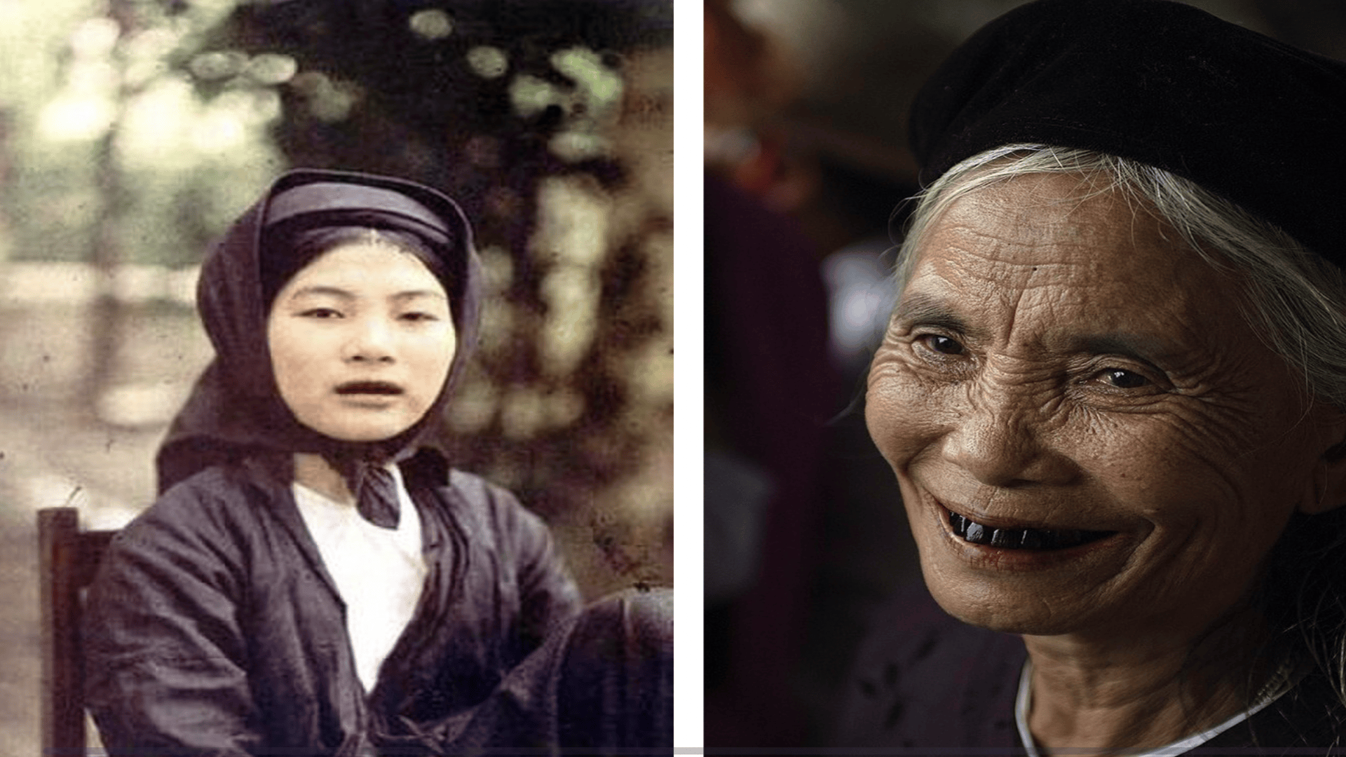 World’s oldest evidence of tooth blackening found in 2,000-year-old burial