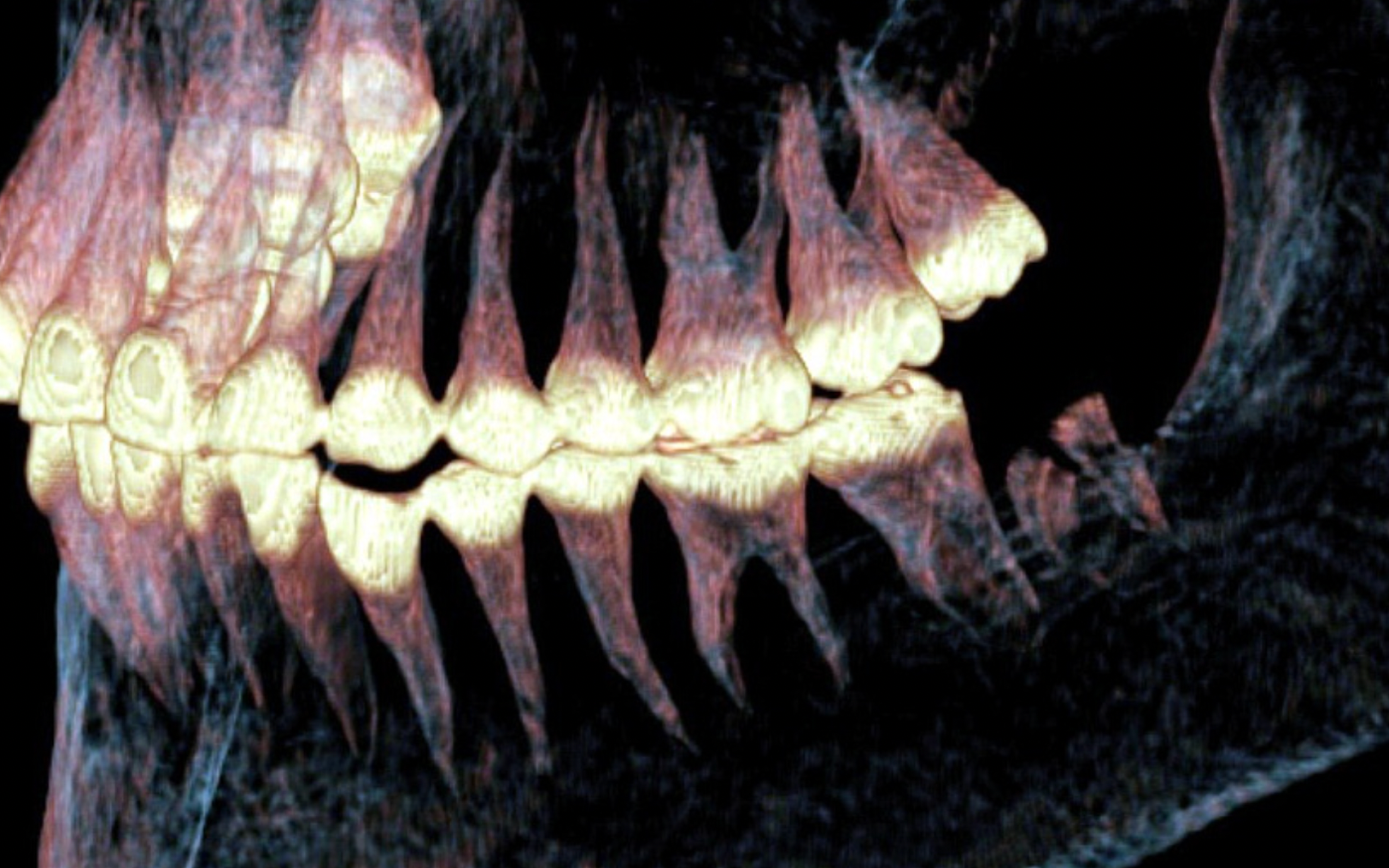 Signs of 2,500-year-old jaw surgery found on Russian woman stun experts