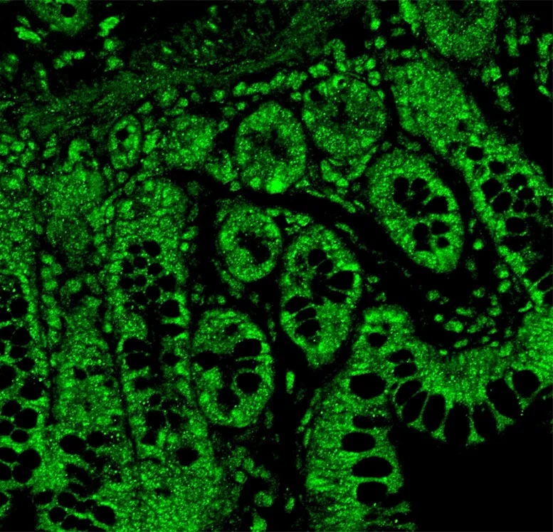 Low-Dose THC May Help Protect the Gut and Liver in HIV