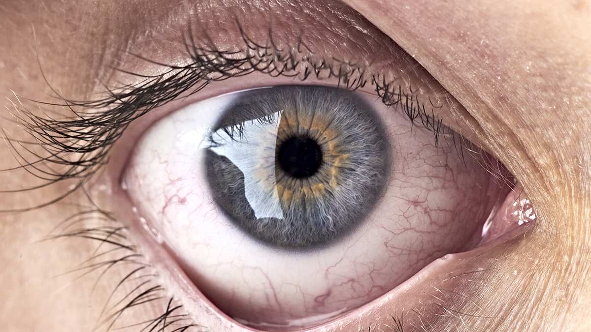 Bacteria at The Back of Your Eye May Be Linked With Alzheimer’s Progress : ScienceAlert