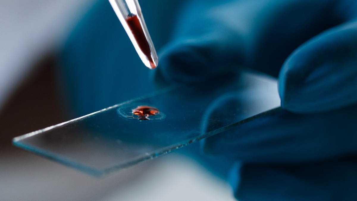 Blood Test ‘Clock’ Can Predict Alzheimer’s Symptoms Before They Emerge : ScienceAlert