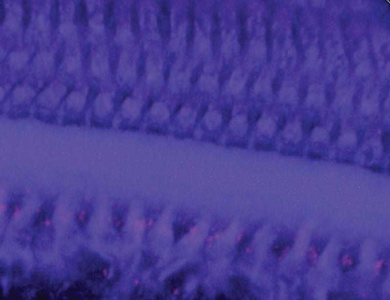 Neutrophil-mediated delivery of antibiotics across the tympanic membrane for otitis media treatment in a preclinical model | Science Translational Medicine