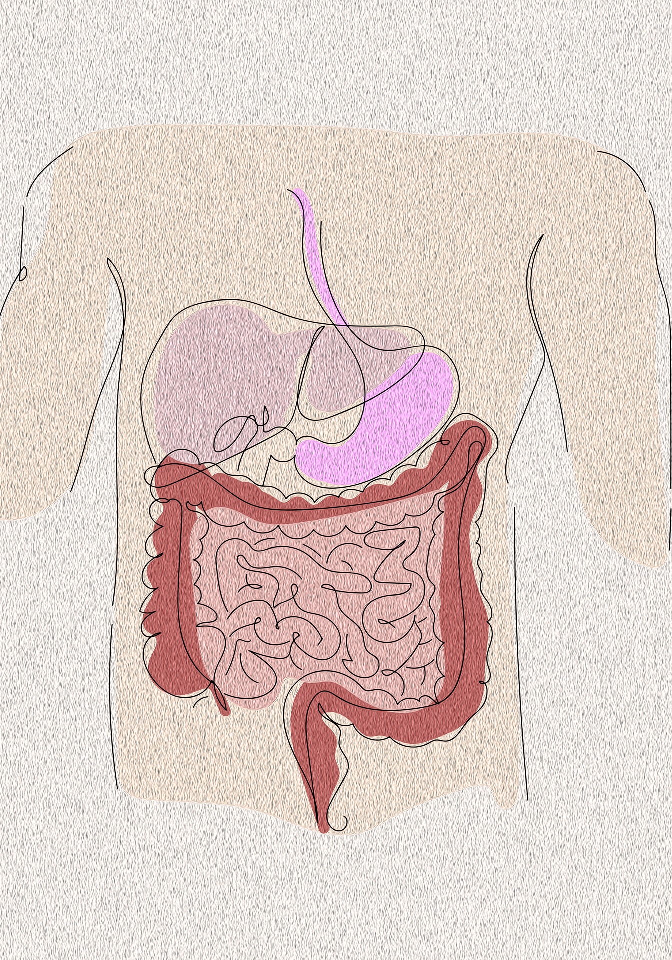 Inflammatory Bowel Disease Drives Colorectal Cancer