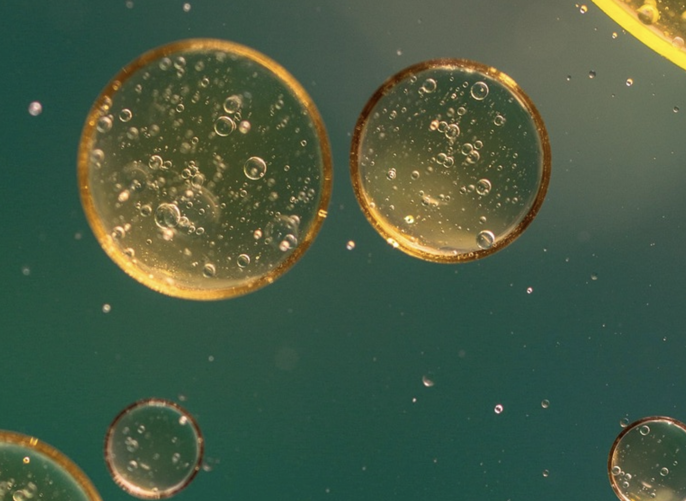 Misplaced Mouth Microbes May Worsen Liver Disease