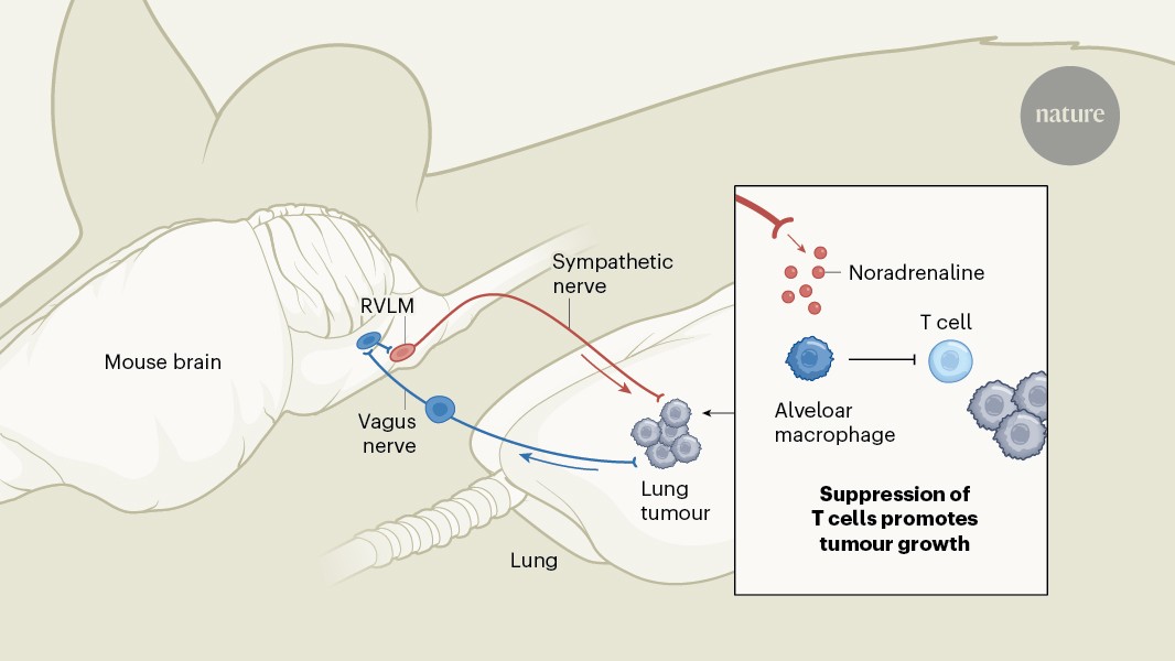 A tumour-to-brain pathway hinders anticancer defences