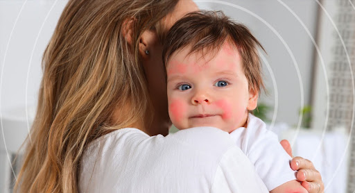 Damaged Skin Barrier Repair from the Inside Out to Fight Pediatric Eczema