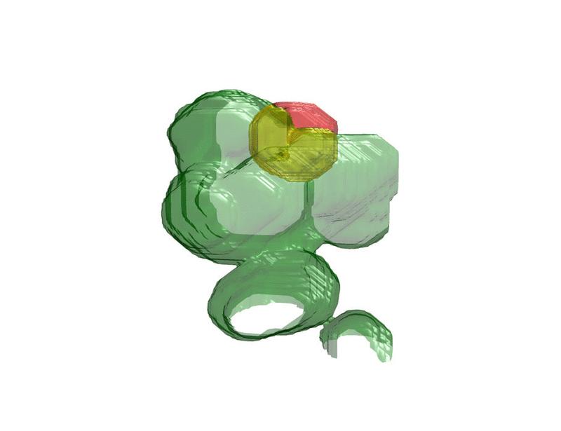 Metabolic acidosis causes a Fanconi-like syndrome with intracellular trafficking defects and proximal tubule dysfunction | Science Translational Medicine