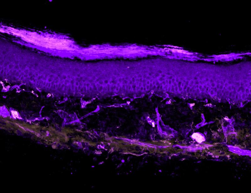 Monocyte-derived IL-10 drives sex differences in pain duration | Science Immunology