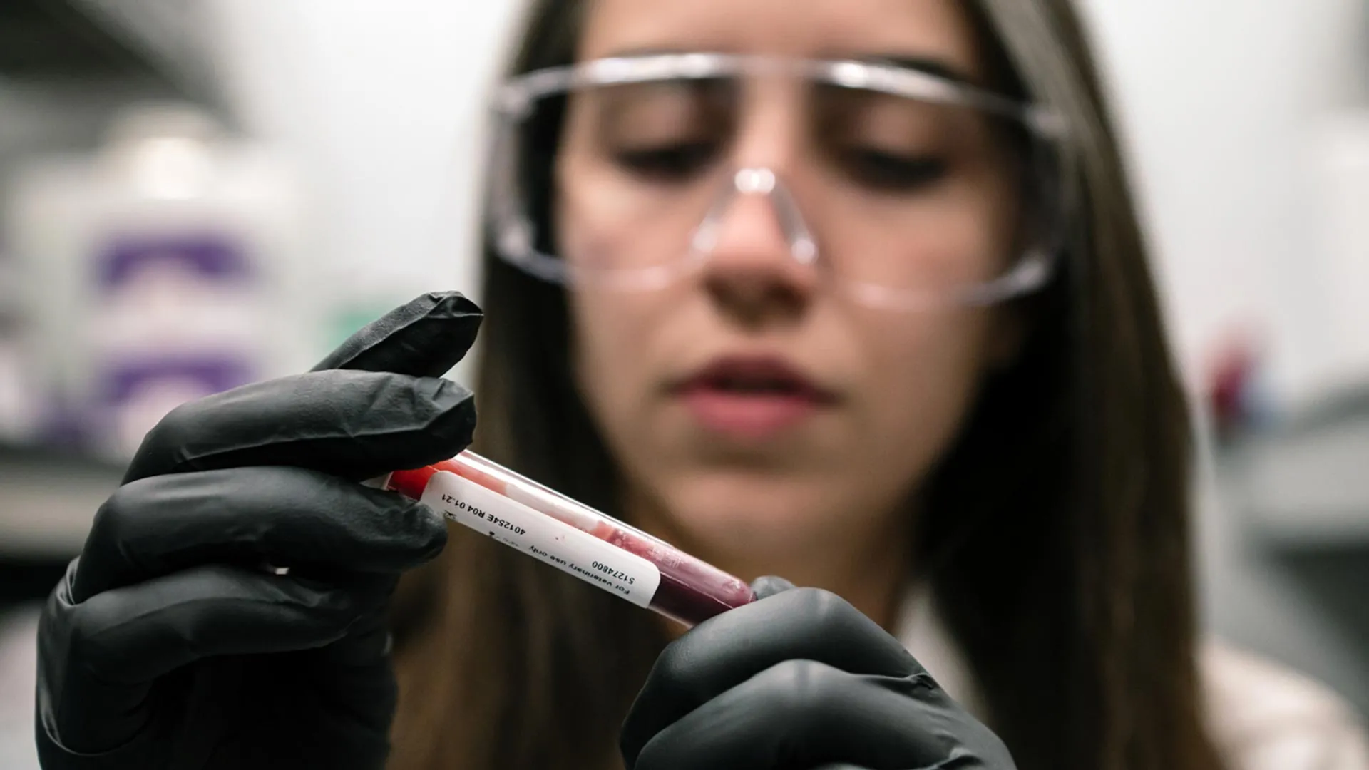 Scientists discover why high altitude protects against diabetes