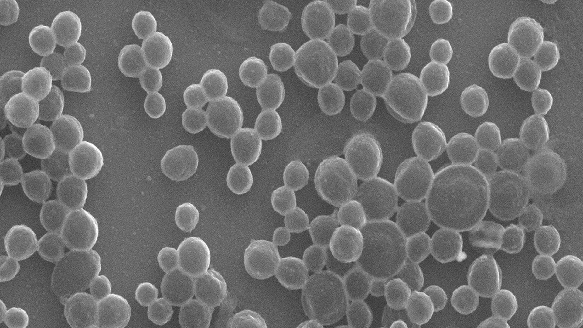 Enzyme-powered bubble robots maneuver drugs directly to tumors