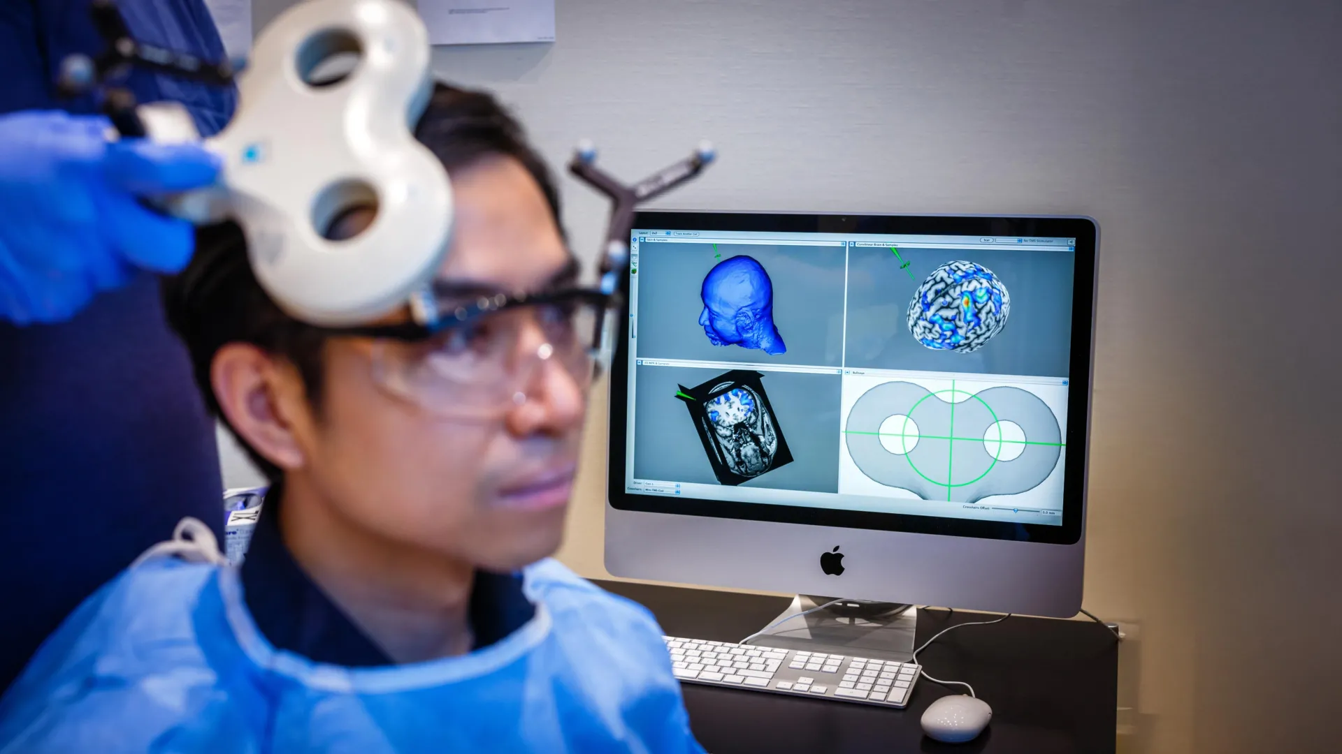 Scientists used brain stimulation to make people more generous