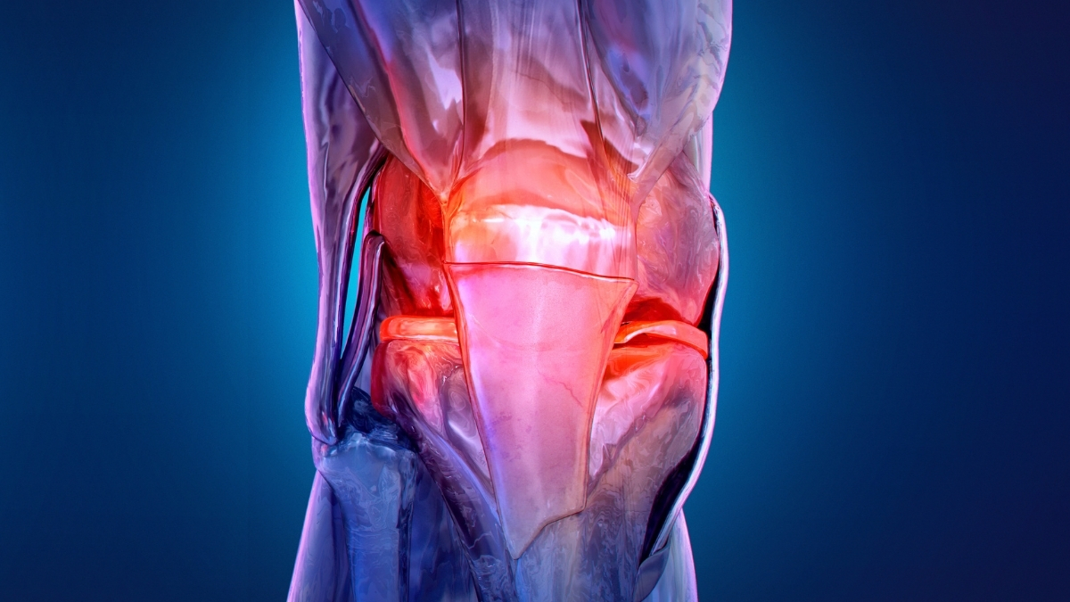 Osteoarthritis Is Appearing in Younger Adults, Triggering Decades of Discomfort : ScienceAlert