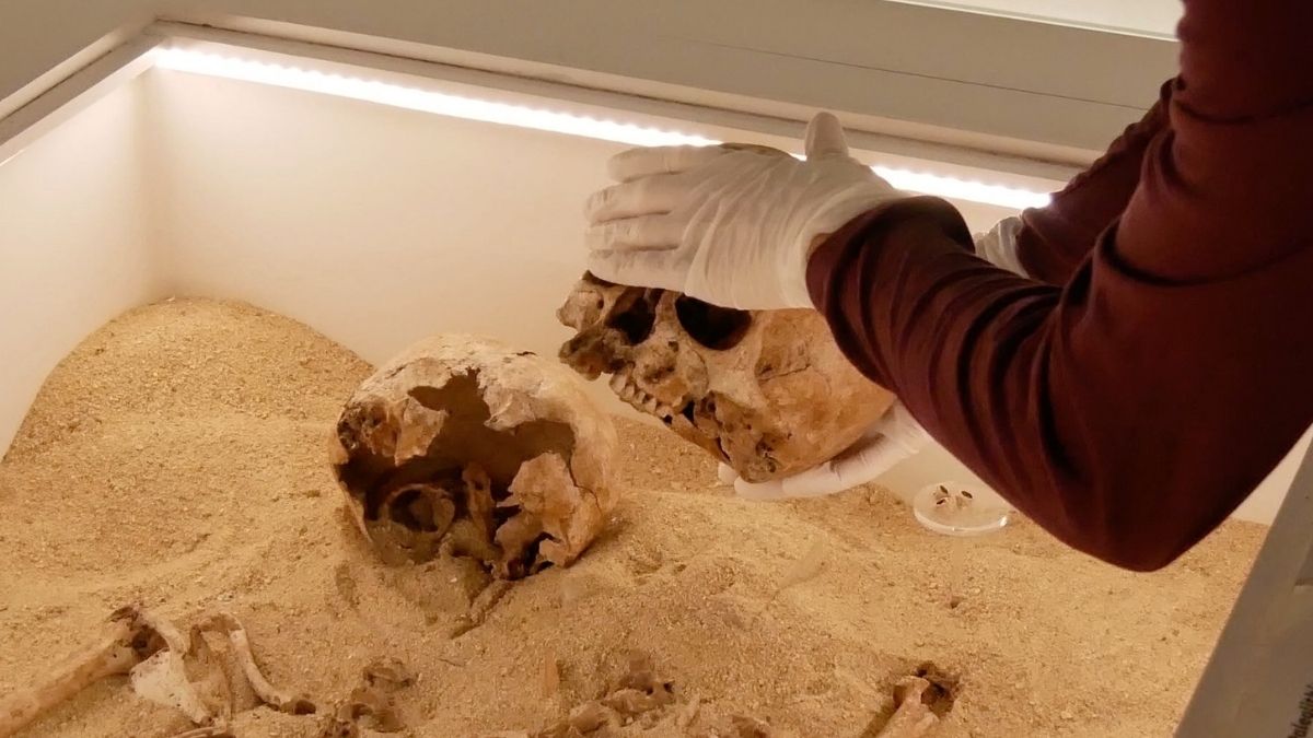 Rare Genetic Disease Discovered in Ancient Skeletal Embrace From The Ice Age : ScienceAlert