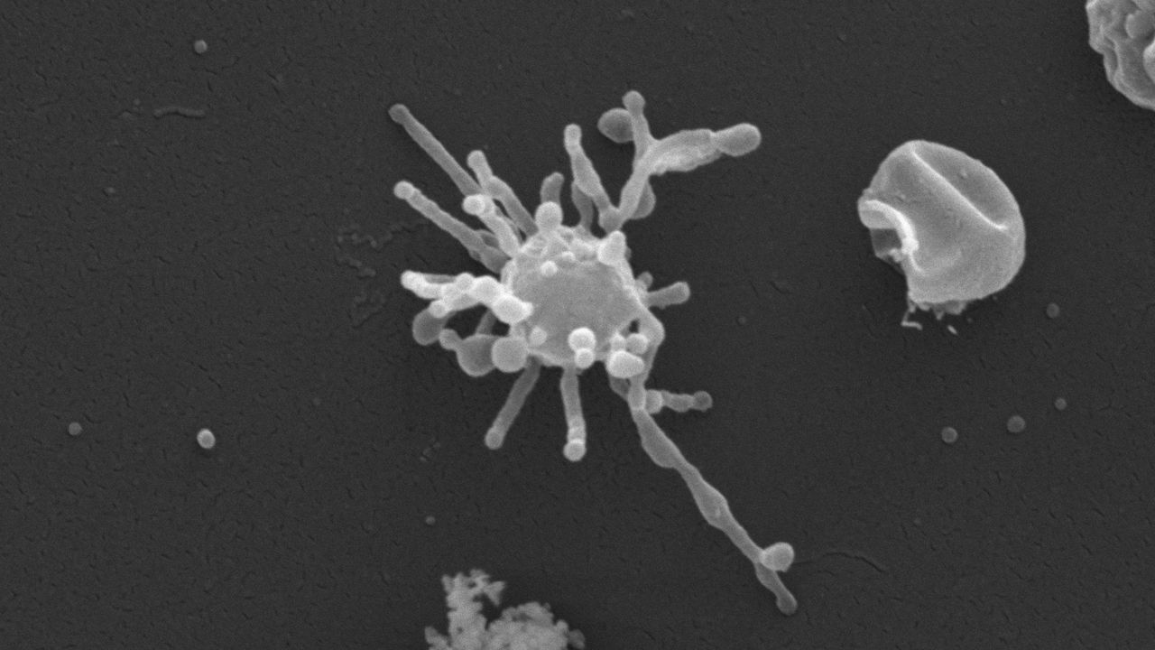 Ancient ‘Asgard’ microbe may have used oxygen long before it was plentiful on Earth, offering new clue to origins of complex life