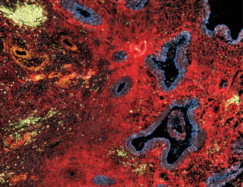 Reconstitution of the uterine immune milieu after uterus or hematopoietic stem cell transplantation | Science Translational Medicine