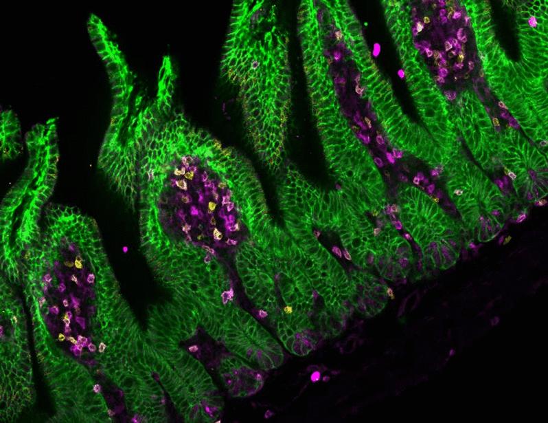 Intestinal epithelial MHC class II induces encephalitogenic CD4 T cells and initiates central nervous system autoimmunity | Science Immunology