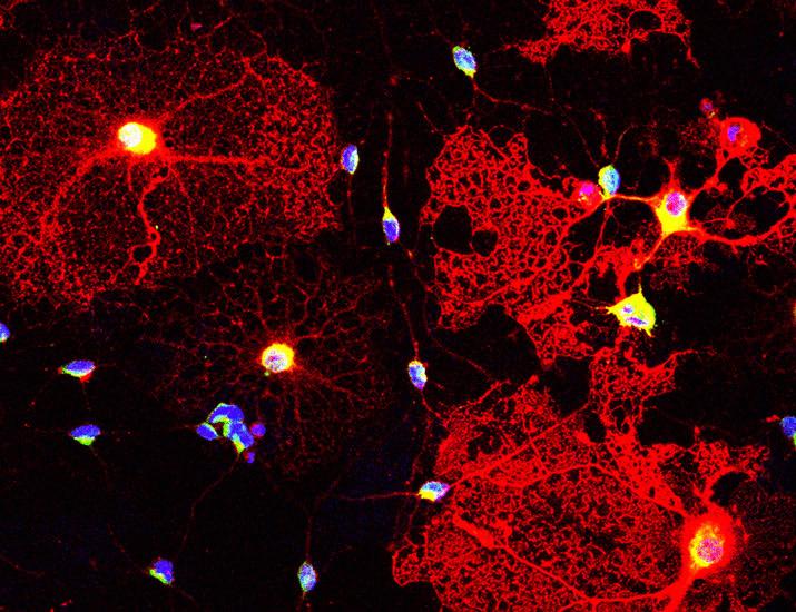 Disruption of the oligodendroglial miR-126a-3p–Pex5 axis inhibits remyelination in chronic demyelinating lesions | Science Translational Medicine
