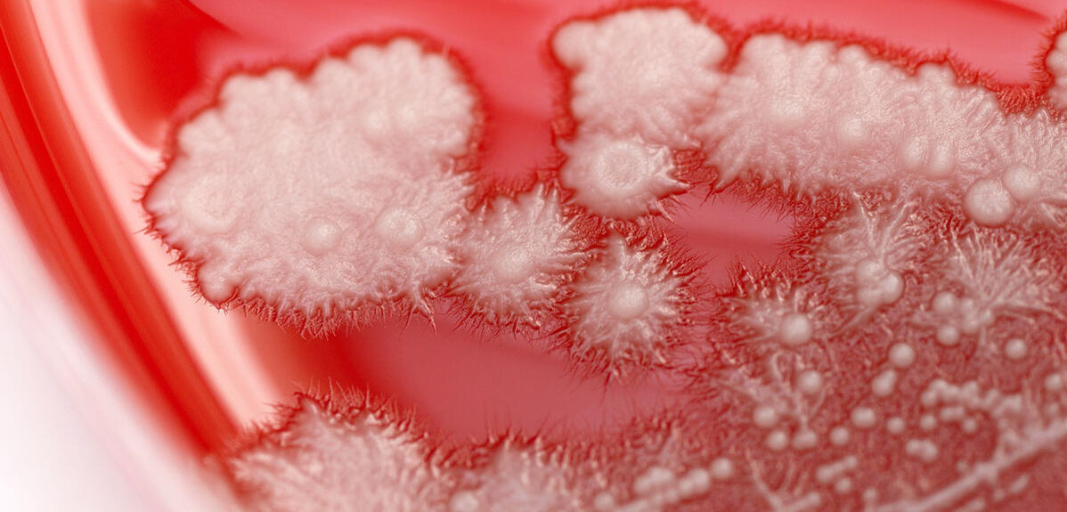 Blocking off highway to infections