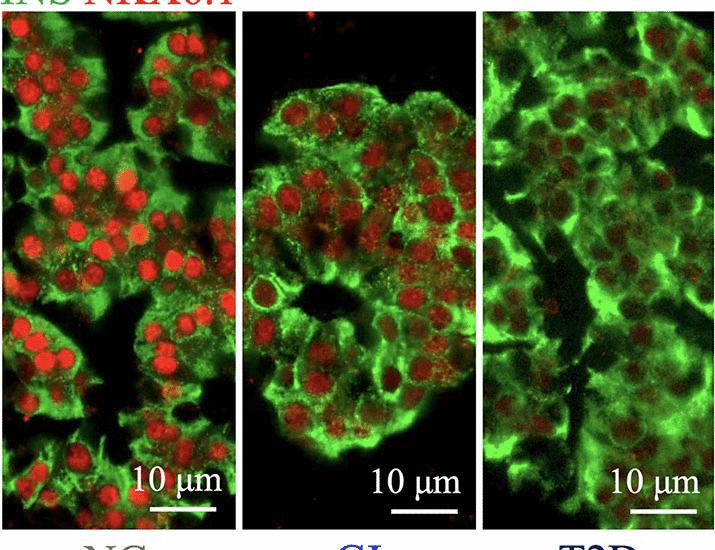 NKX6.1 mRNA copy number is an actionable biomarker associated with islet function and clinical outcomes after islet transplantation | Science Translational Medicine