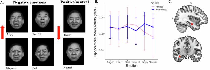 Emotional scars: limbic brain processing alterations in adults with childhood abuse across mental health disorders