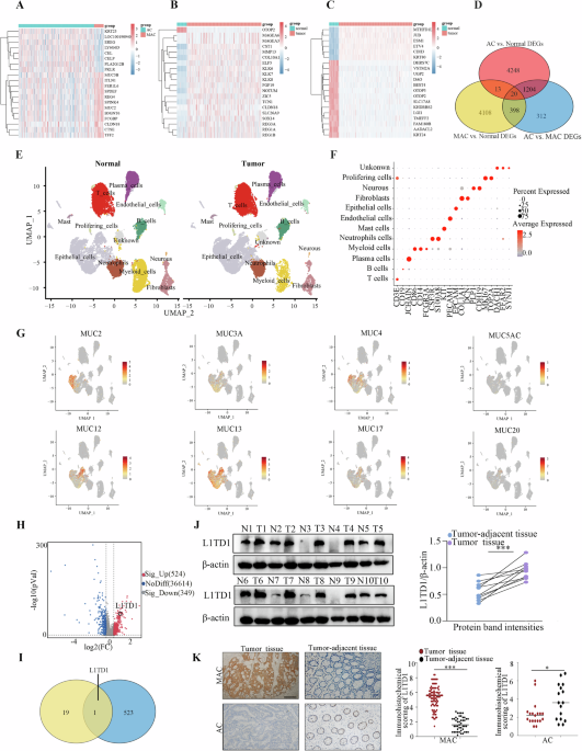 L1TD1 promotes colorectal mucinous adenocarcinoma progression by enhancing ABCC3 mRNA stability