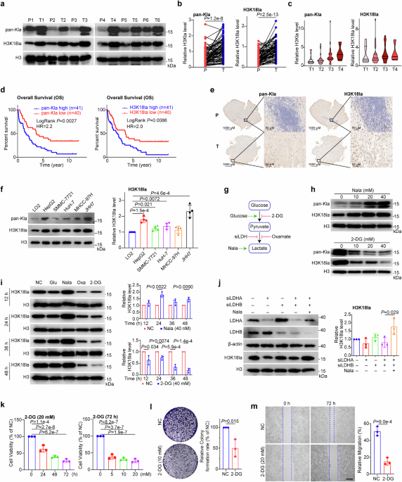 BRD9 recognizes lactate-induced H3K18 lactylation to drive oncogenic chromatin remodeling in hepatocellular carcinoma