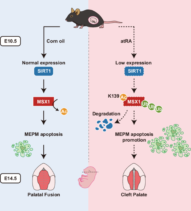 Acetylation-triggered degradation of MSX1 impairs palatal development