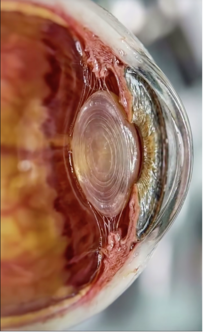 When ophthalmology goes viral: AI-generated content and the viral spread of medical knowledge on social media