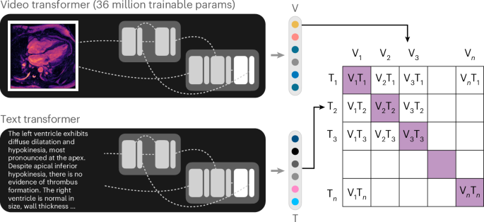 Building foundation models for cardiac MRI