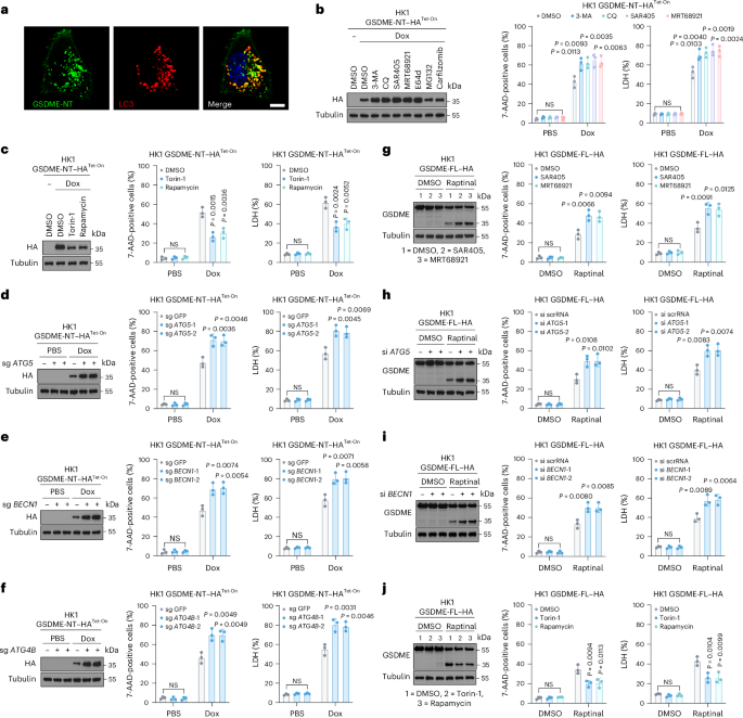 TOLLIP targets GSDME-NT-carrying endocytic vesicles for autophagy to regulate pyroptosis and chemotherapy efficacy